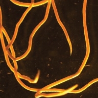 Dictyocaulus viviparus