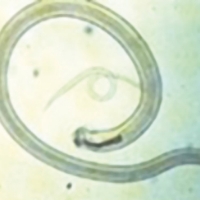 Ostertagia ostertagi